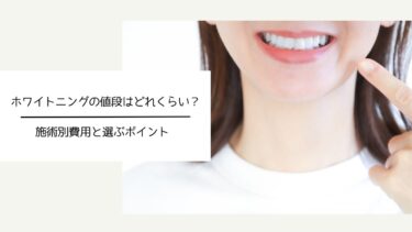 ホワイトニングの値段はどれくらい？施術別費用と選ぶポイント